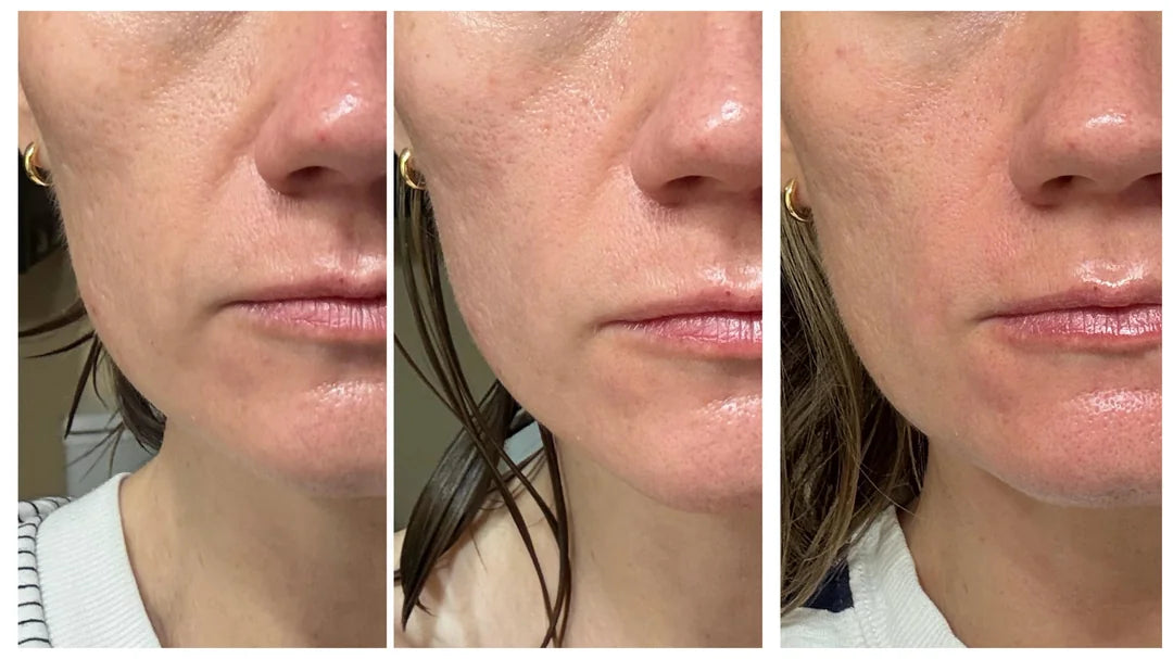 Does Volufiline™ Actually Work or Is It Just Hype?