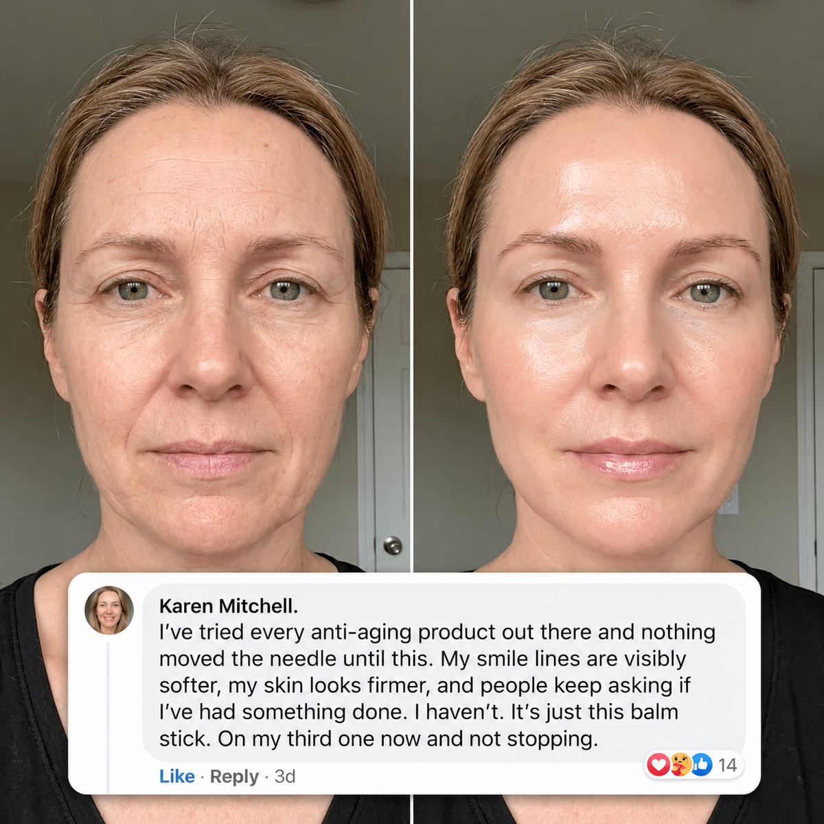 Revival NAD+ EGF Multi Balm
